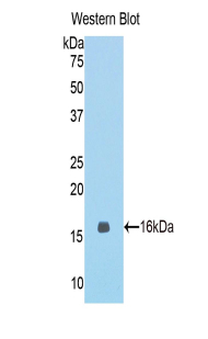 Polyclonal Antibody to Meningioma Expressed Antigen 5 (MGEA5)