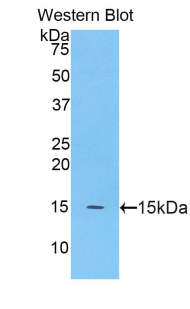 Polyclonal Antibody to Meningioma Expressed Antigen 5 (MGEA5)