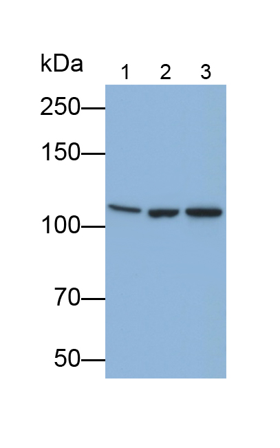 Polyclonal Antibody to Meningioma Expressed Antigen 5 (MGEA5)