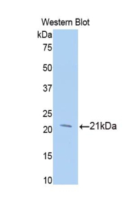 Polyclonal Antibody to Meningioma Expressed Antigen 5 (MGEA5)