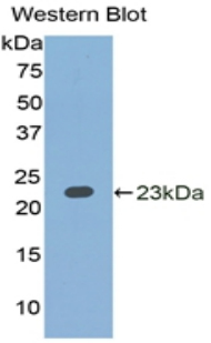 Polyclonal Antibody to Interleukin 1 Alpha (IL1a)