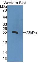 Polyclonal Antibody to Interleukin 2 (IL2)