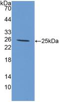 Polyclonal Antibody to Interleukin 6 (IL6)