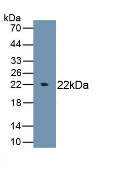 Polyclonal Antibody to Interleukin 6 (IL6)