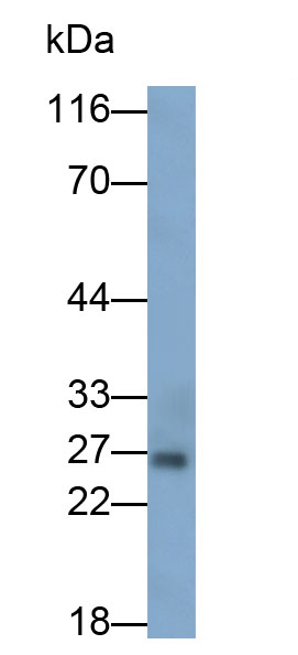 Polyclonal Antibody to Interleukin 6 (IL6)