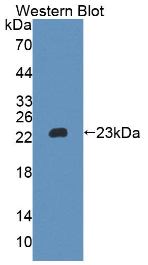 Polyclonal Antibody to Interleukin 6 (IL6)