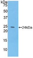 Polyclonal Antibody to Interleukin 6 (IL6)