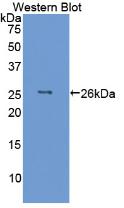 Polyclonal Antibody to Interleukin 6 (IL6)