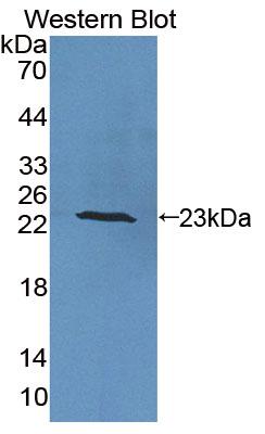 Polyclonal Antibody to Interleukin 6 (IL6)