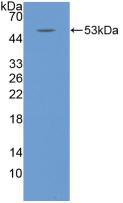 Polyclonal Antibody to Interleukin 6 (IL6)