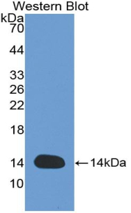 Polyclonal Antibody to Interleukin 8 (IL8)