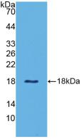 Polyclonal Antibody to Leptin (LEP)