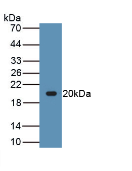 Polyclonal Antibody to Leptin (LEP)