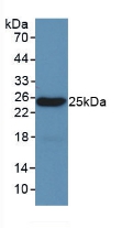 Polyclonal Antibody to Leptin (LEP)