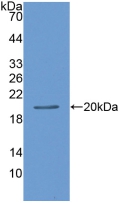 Polyclonal Antibody to Leptin (LEP)