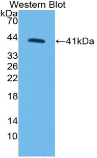 Polyclonal Antibody to Monocyte Chemotactic Protein 1 (MCP1)