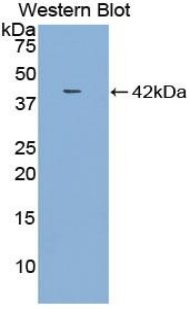 Polyclonal Antibody to Macrophage Inflammatory Protein 1 Beta (MIP1b)