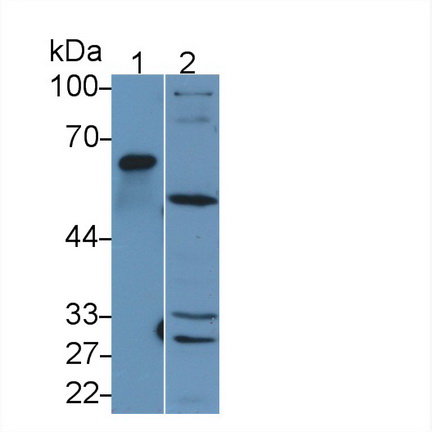 Polyclonal Antibody to Matrix Metalloproteinase 1 (MMP1)