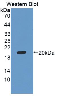 Polyclonal Antibody to Matrix Metalloproteinase 13 (MMP13)