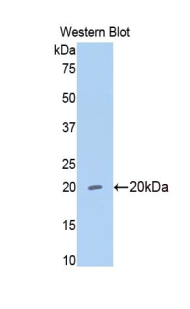 Polyclonal Antibody to Matrix Metalloproteinase 13 (MMP13)