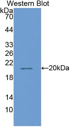 Polyclonal Antibody to Matrix Metalloproteinase 13 (MMP13)