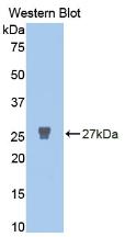 Polyclonal Antibody to Matrix Metalloproteinase 2 (MMP2)