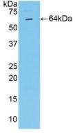 Polyclonal Antibody to Matrix Metalloproteinase 2 (MMP2)