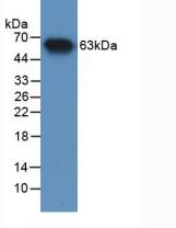 Polyclonal Antibody to Matrix Metalloproteinase 2 (MMP2)