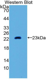 Polyclonal Antibody to Matrix Metalloproteinase 3 (MMP3)