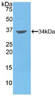 Polyclonal Antibody to Matrix Metalloproteinase 7 (MMP7)