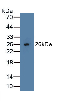 PAA108Hu01.jpg