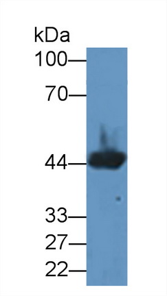 Polyclonal Antibody to Creatine Kinase, Muscle (CKM)