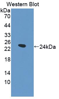 Polyclonal Antibody to Oncostatin M (OSM)