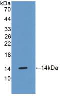 Polyclonal Antibody to Oncostatin M (OSM)