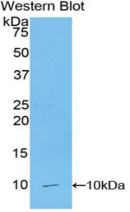 Polyclonal Antibody to Regulated On Activation In Normal T-Cell Expressed And Secreted (RANTES)