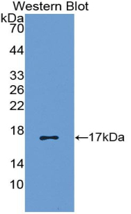 Polyclonal Antibody to Regulated On Activation In Normal T-Cell Expressed And Secreted (RANTES)