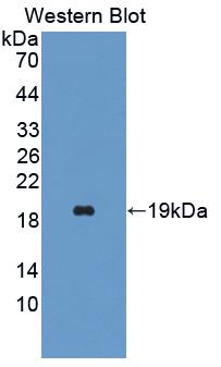 Polyclonal Antibody to Superoxide Dismutase 3, Extracellular (SOD3)