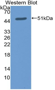 Polyclonal Antibody to Cluster Of Differentiation 30 Ligand (CD30L)