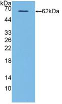 Polyclonal Antibody to Cluster Of Differentiation 40 Ligand (CD40L)