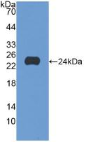 Polyclonal Antibody to Stem Cell Factor Receptor (SCFR)