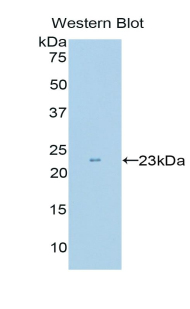 Polyclonal Antibody to Stem Cell Factor Receptor (SCFR)