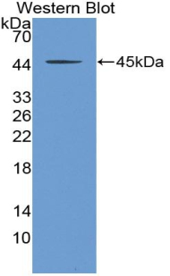 Polyclonal Antibody to Transforming Growth Factor Beta 1 (TGFb1)