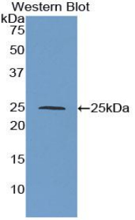 Polyclonal Antibody to Tissue Inhibitors Of Metalloproteinase 3 (TIMP3)