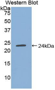 Polyclonal Antibody to Tissue Inhibitors Of Metalloproteinase 4 (TIMP4)