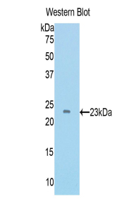 Polyclonal Antibody to Tissue Inhibitors Of Metalloproteinase 4 (TIMP4)