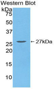 PAA131Hu01.jpg