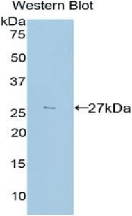 Polyclonal Antibody to Transforming Growth Factor Beta Induced Protein (TGFbI)