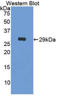 Polyclonal Antibody to Tumor Necrosis Factor Alpha (TNFa)