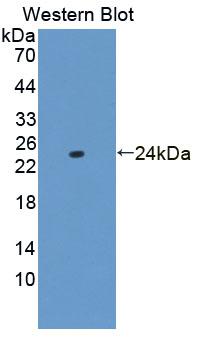 Polyclonal Antibody to Tumor Necrosis Factor Alpha (TNFa)