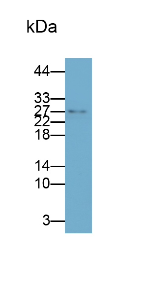 Polyclonal Antibody to Tumor Necrosis Factor Alpha (TNFa)